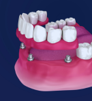 service-image